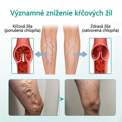🛡️CleraNature® LegRenew Náplasti na kŕčové žily