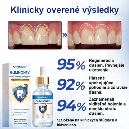 COLTURE® GumHoney kvapky na opravu ústnej dutiny