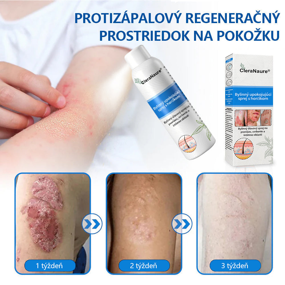 ClereNature® Magnesium Spray – Rýchla úľava pre svrbivú, červenú a citlivú pokožku (aj intímne oblasti)