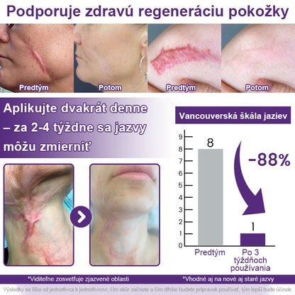 CleraNaure® ReGenScar – gél s kmeňovými bunkami na jazvy