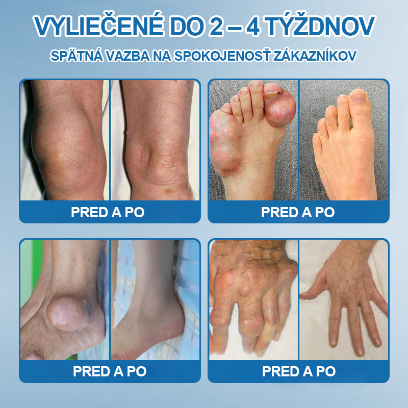 🥇 Posledný deň akcie 80% ZĽAVA | 🇸🇰 CleraNature® BPC-157 Krém na hojenie kĺbov 🦴 Lieči artritídu, neuropatiu, reumatizmus, športové zranenia a ďalšie