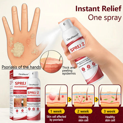 🥇CleraNature® Beef Tallow Spray na svrbiacu, olupujúcu pokožku pri psoriáze🥇