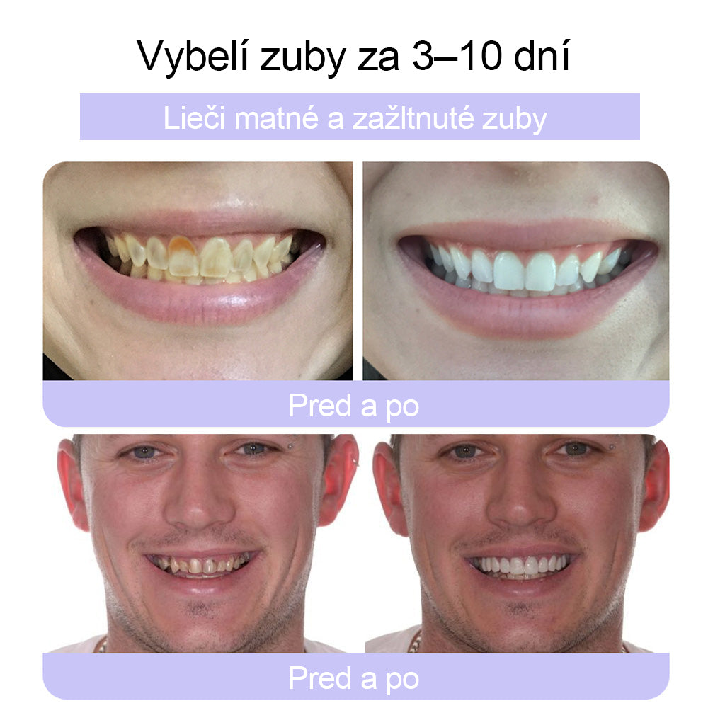 🦷🦷CleraNature® prášok na obnovu zubov🔮