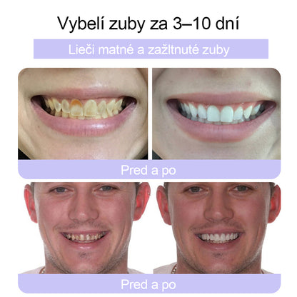 🦷🦷CleraNature® prášok na obnovu zubov🔮