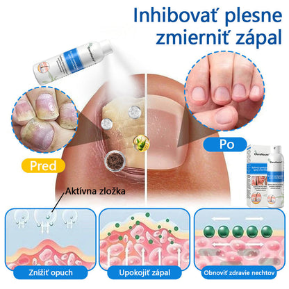 ClereNature® Magnesium Spray – Rýchla úľava pre svrbivú, červenú a citlivú pokožku (aj intímne oblasti)
