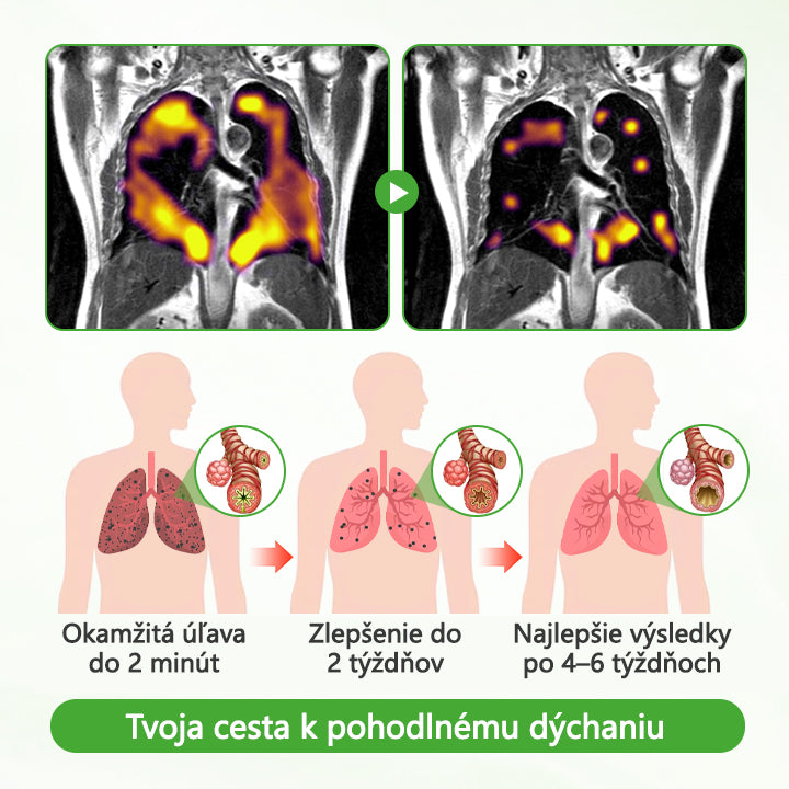✅CleraNature® HerbaAir – Čistič pľúc s divozelom