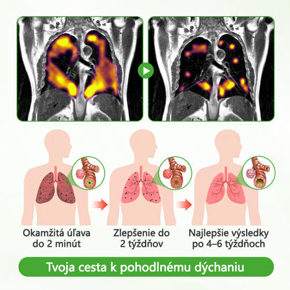 ✅CleraNature® HerbaAir – Čistič pľúc s divozelom
