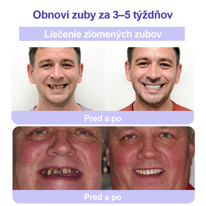 🦷🦷CleraNature® prášok na obnovu zubov🔮