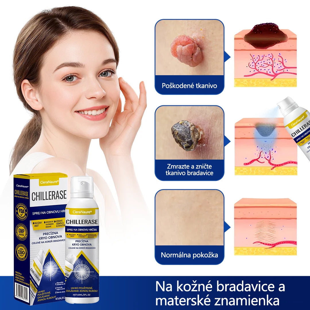 💎CleraNature® ChillErase sprej na obnovu hrbolčekov