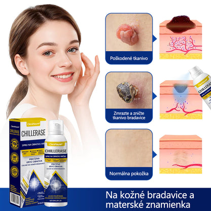 💎CleraNature® ChillErase sprej na obnovu hrbolčekov