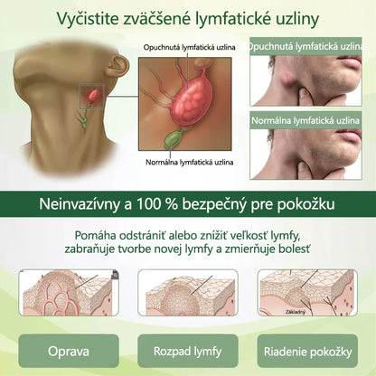 ✨Povedzte zbohom opuchnutým, boľavým nohám – CleraNaure® FluidEase Profesionálny krém na zlepšenie krvného obehu v nohách prináša skutočnú úľavu! ✨🦵