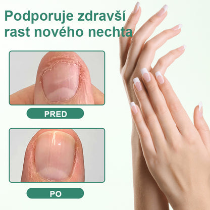 CleraNaure® Penetračné sérum na detoxikáciu nechtov