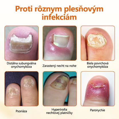 CleraNature® FungiBee Pokročilý sprej na opravu nechtov