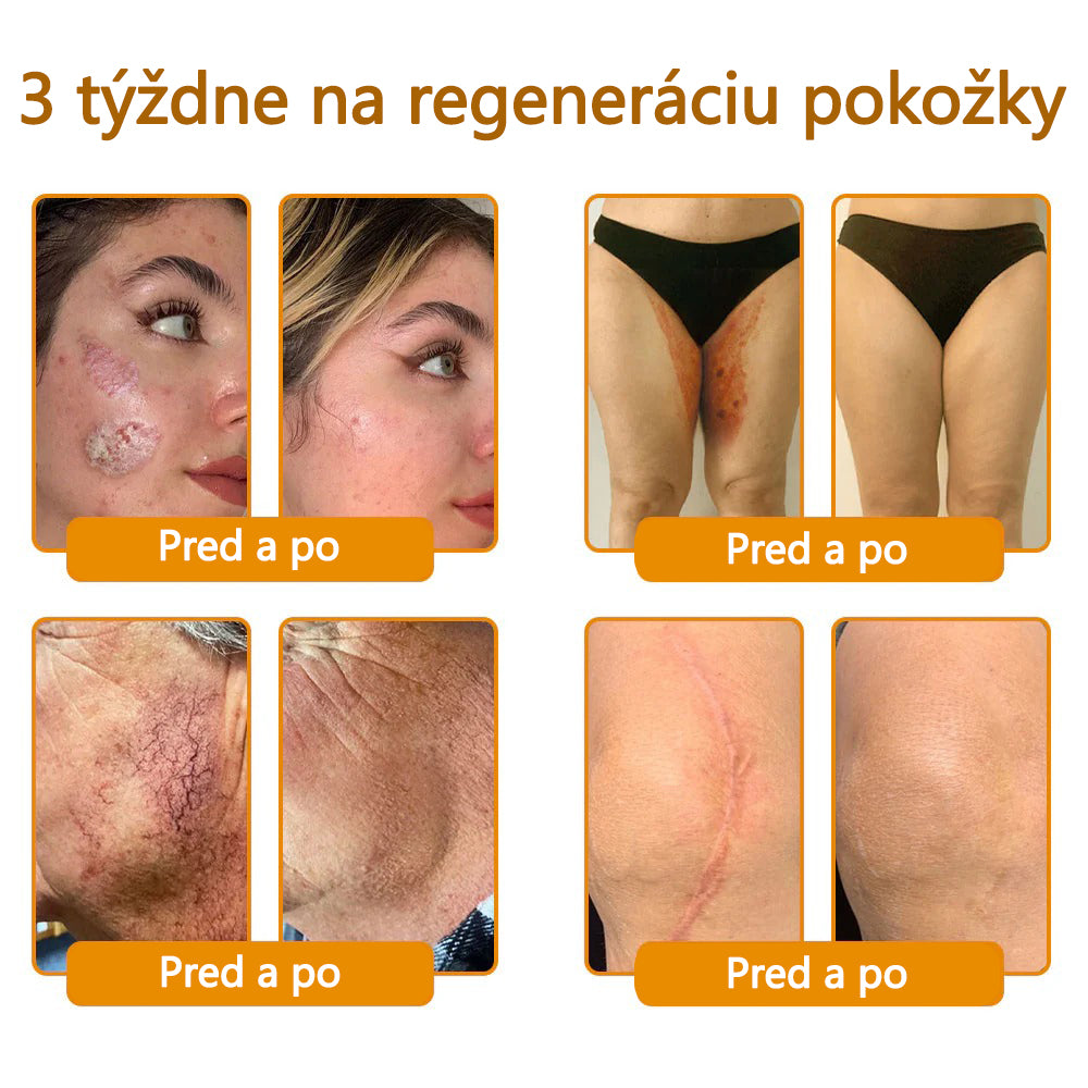 CleraNaure® Krém na obnovu pokožky s včelím jedom