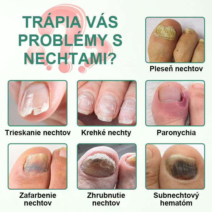CleraNaure® Penetračné sérum na detoxikáciu nechtov