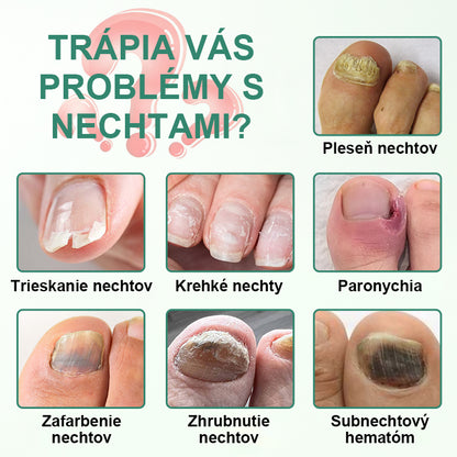 CleraNaure® Penetračné sérum na detoxikáciu nechtov