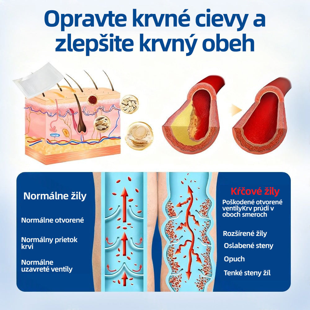 💙Healrize® VeinTarget mikrojihlová náplasť